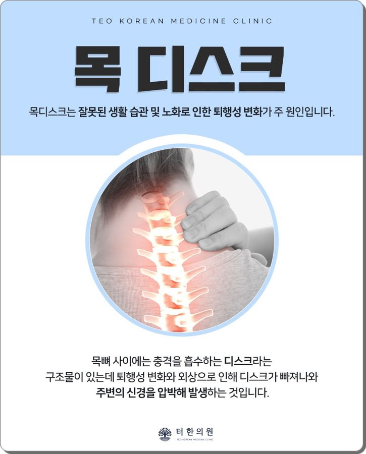 목 디스크를 설명한 안내문