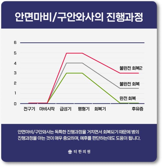 안면마비와 구안와사의 단계별 진행과 회복 곡선을 나타낸 그래프