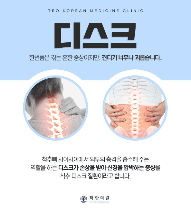 목과 허리 디스크를 설명한 안내 그림